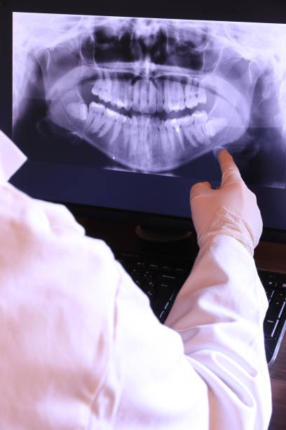 Best Emergency Treatment for Dental Infections or Abscesses in Vidalia, LA