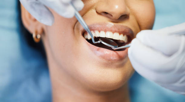 Professional Emergency Dentist in LA